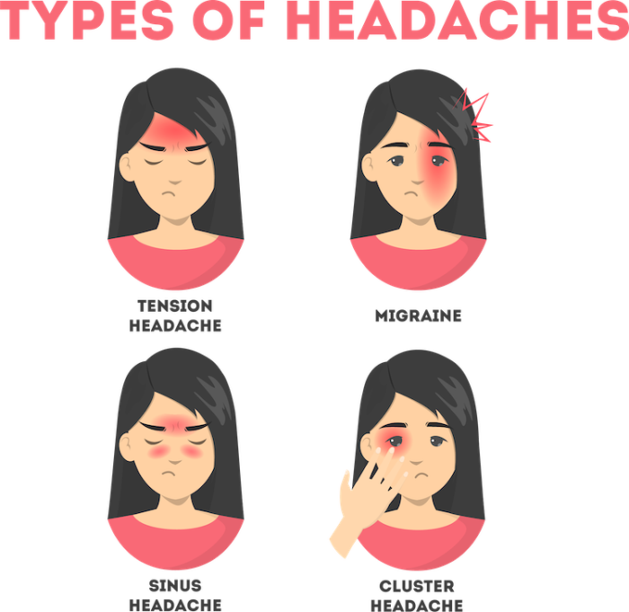 Headache Pain & How To Treat It | AllSpine