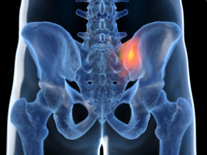 Sacroiliac Joint scanning