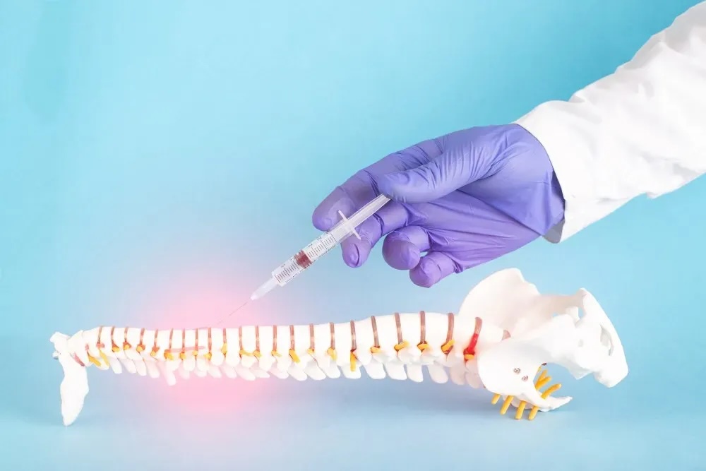 Epidural Injections for Pain Management